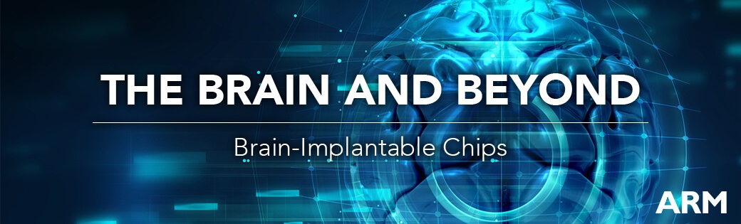 Brain Implantable in healthcare with bbci csne cortex m0